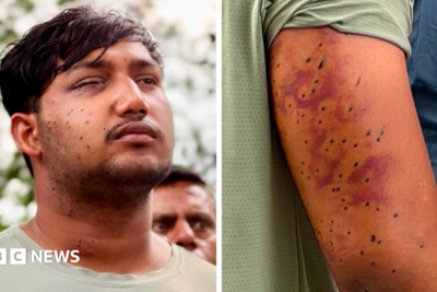 India's 'cockroach' protesters have wounds consistent with pellet-gun fire, say experts