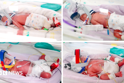 Rare identical quadruplets born in Australia